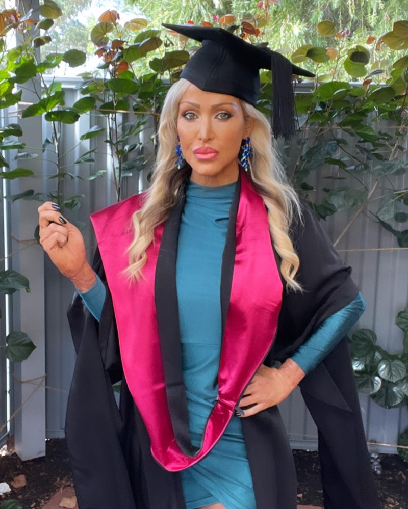 สาวโดนเผาร่าง