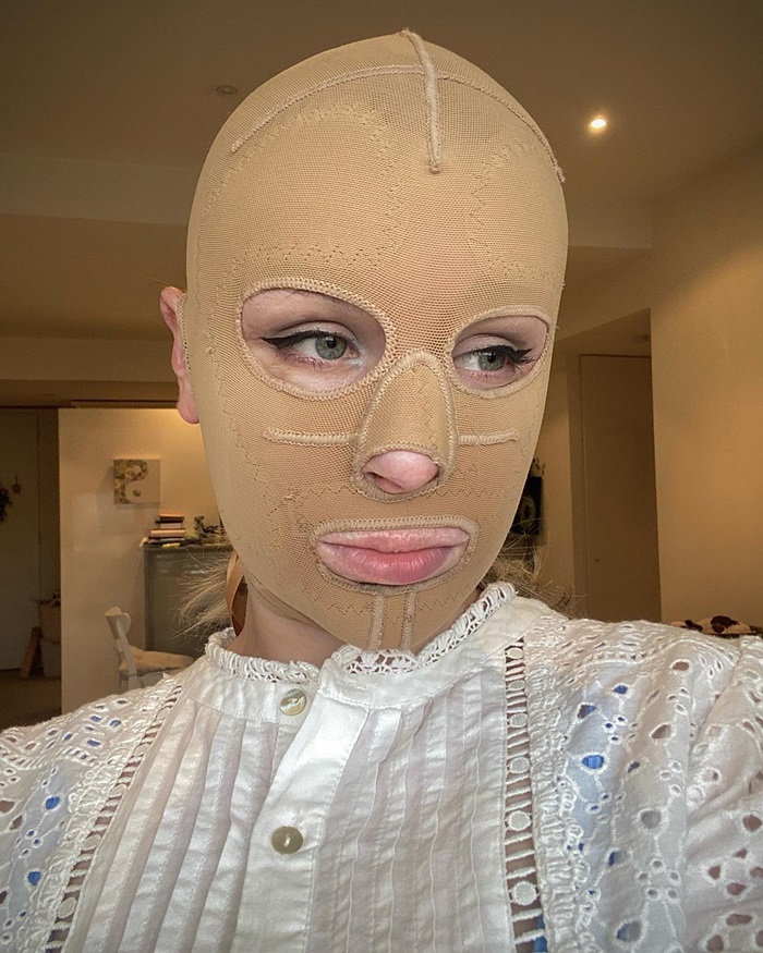 รอดตายจากภูเขาไฟระเบิด