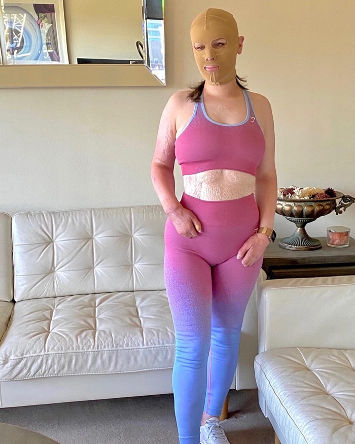 รอดตายจากภูเขาไฟระเบิด