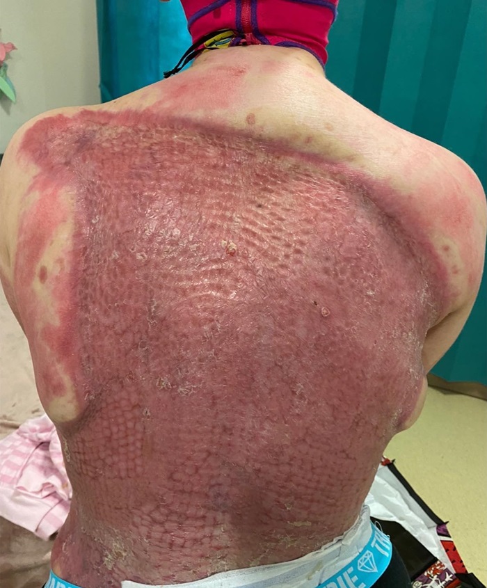 รอดตายจากภูเขาไฟระเบิด