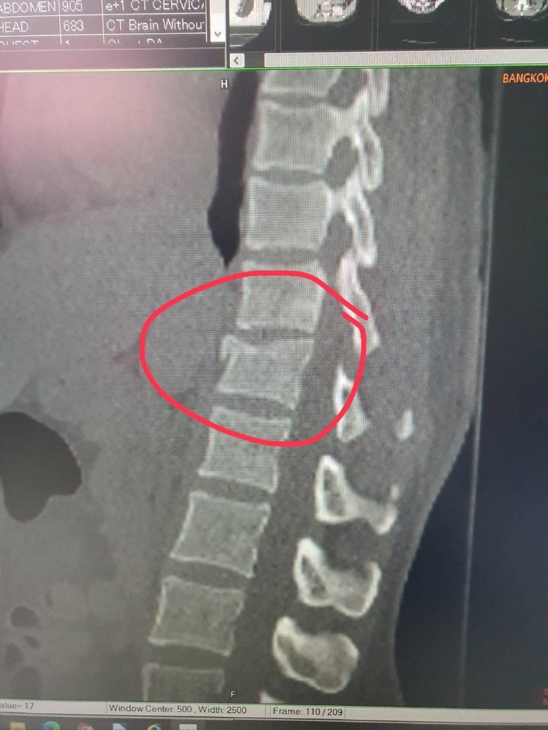 หมอโอ๋ เลี้ยงลูกนอกบ้าน