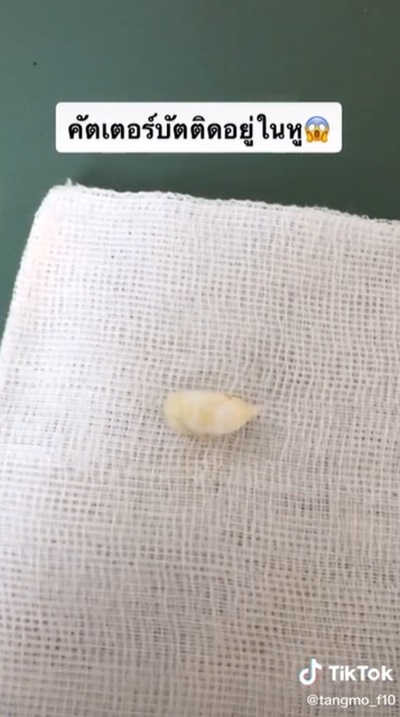 คอตตอนบัดติดหู