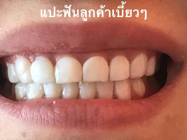 แฉหมอฟัน