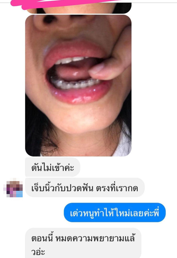 แฉหมอฟัน