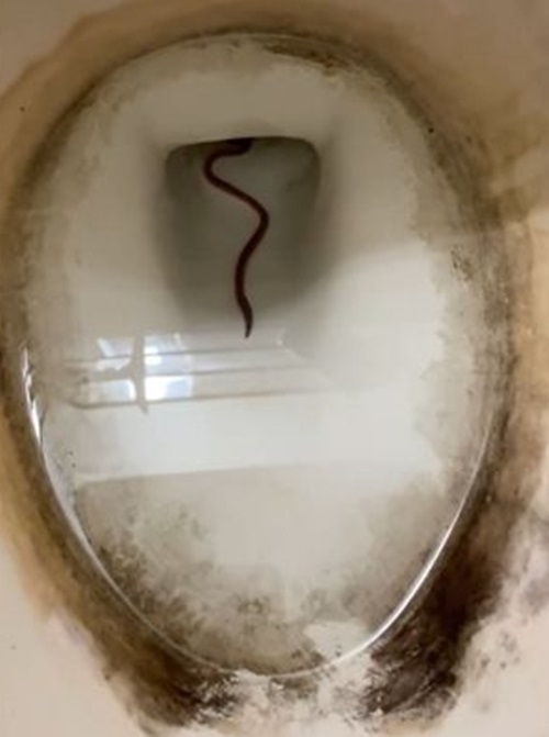 ชักโครกสกปรก