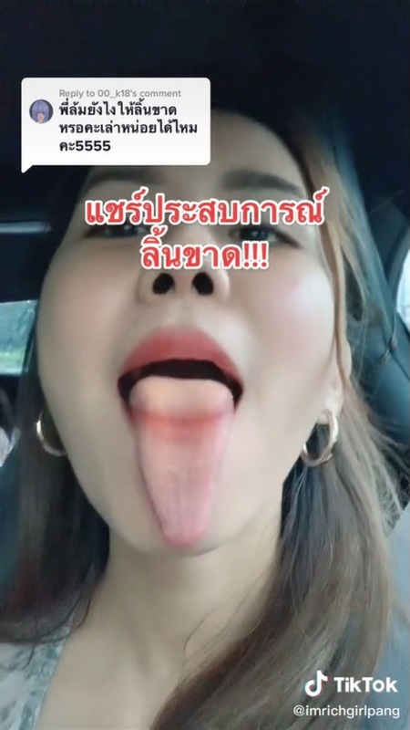 แชร์ประสบการณ์ลิ้นขาด