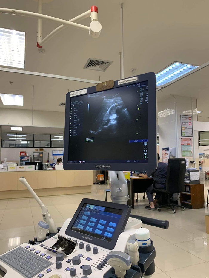 ถุงน้ำดีเน่า