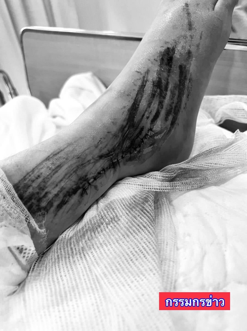 อุบัติเหตุ BTS สุรศักดิ์