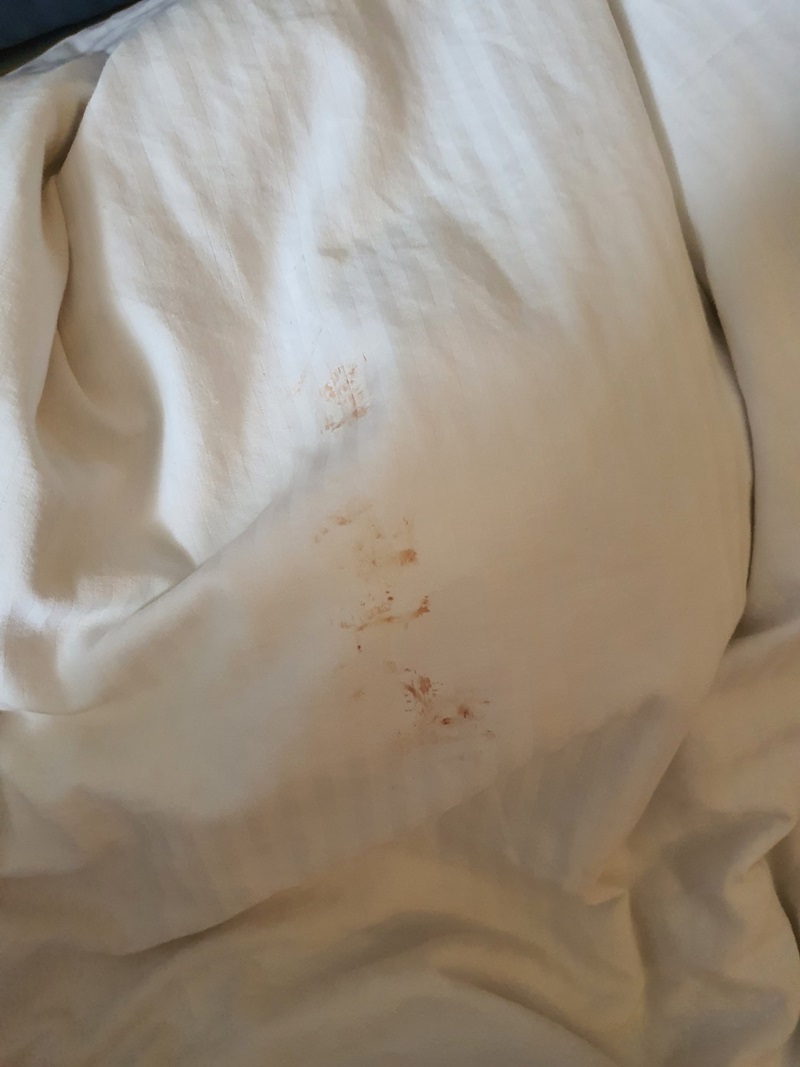 คราบเลือด อสุจิ บนผ้าปูเตียงโรงแรมหรู