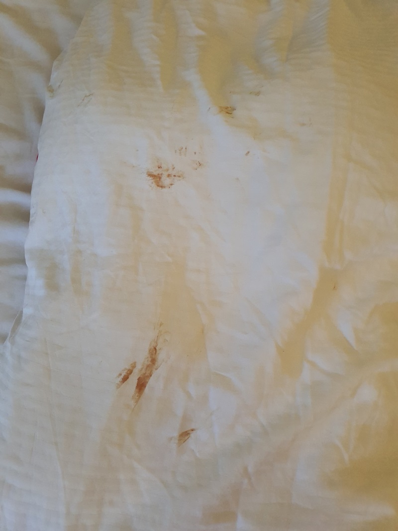 คราบเลือด อสุจิ บนผ้าปูเตียงโรงแรมหรู