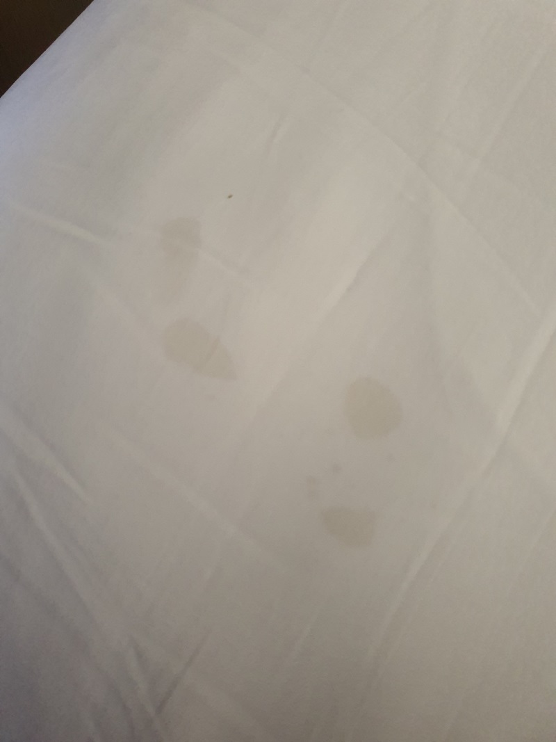 คราบเลือด อสุจิ บนผ้าปูเตียงโรงแรมหรู