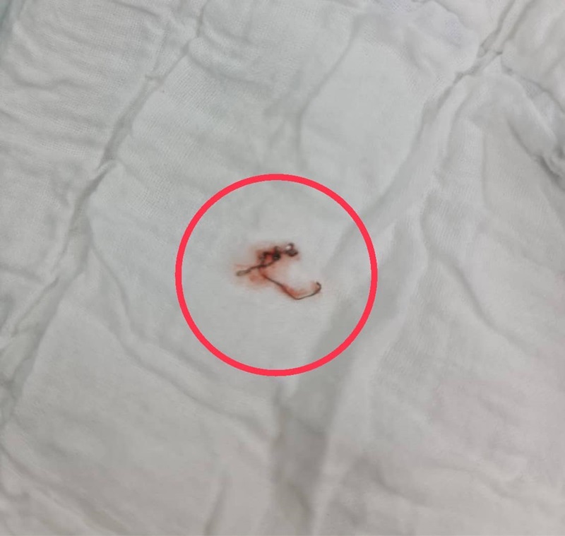 ฝอยขัดหม้อติดคอ