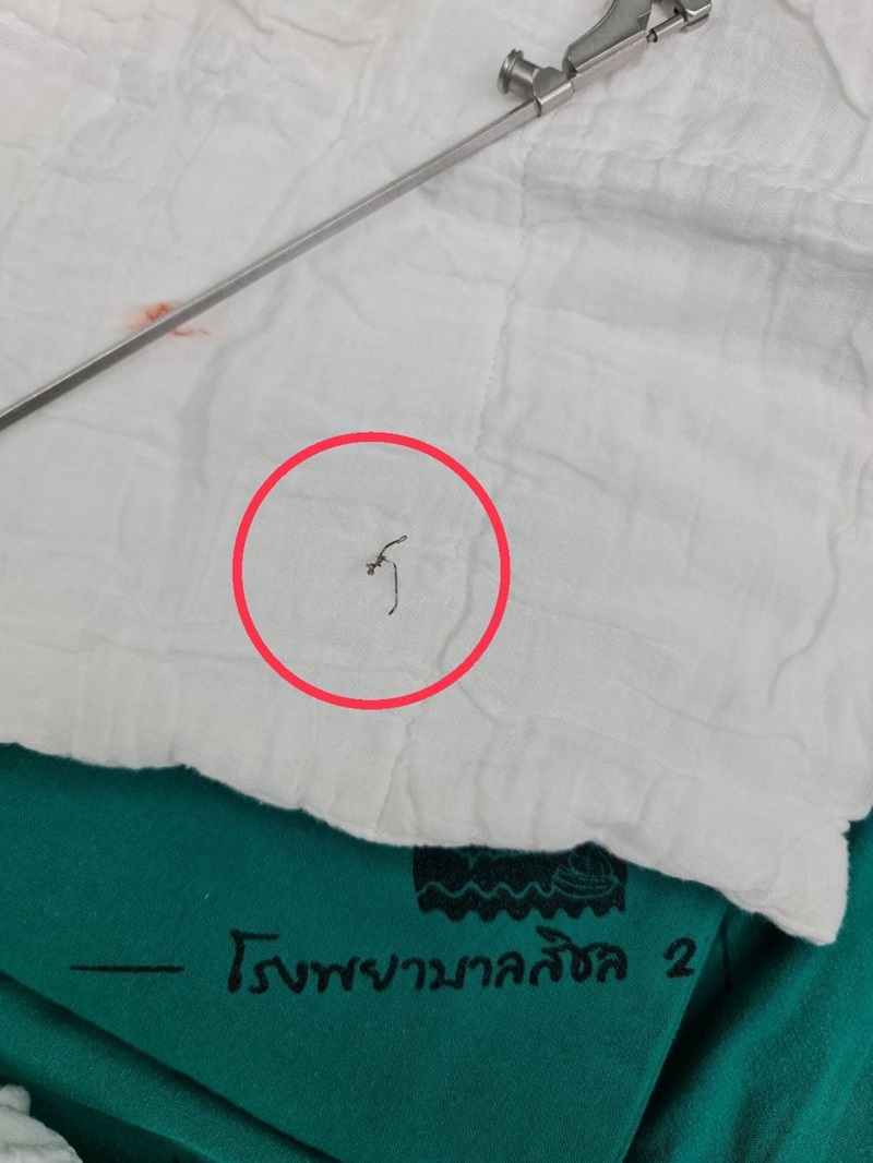 ฝอยขัดหม้อติดคอ