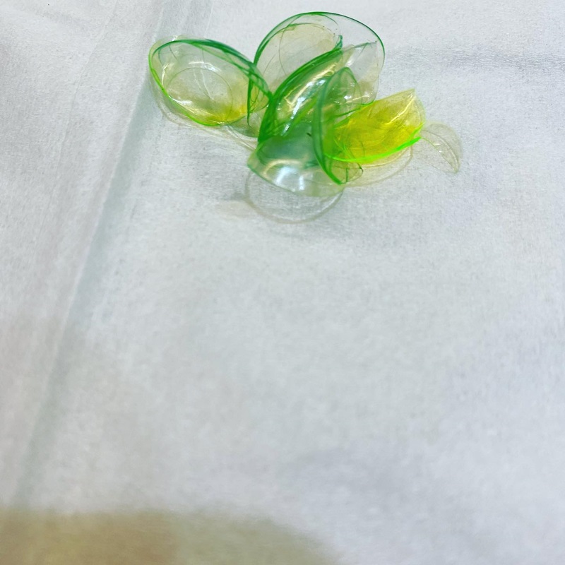 ลืมถอดคอนแทคเลนส์