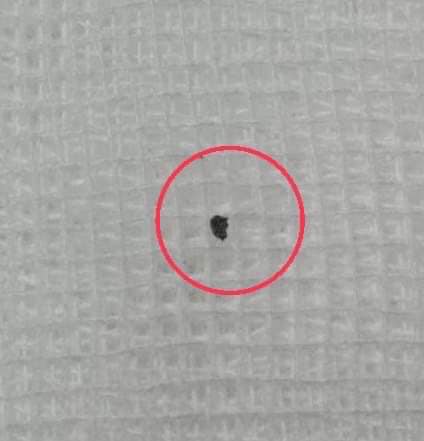 หินเข้าตา