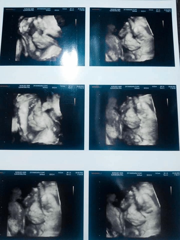 กราดยิงหนองบัวลําภู