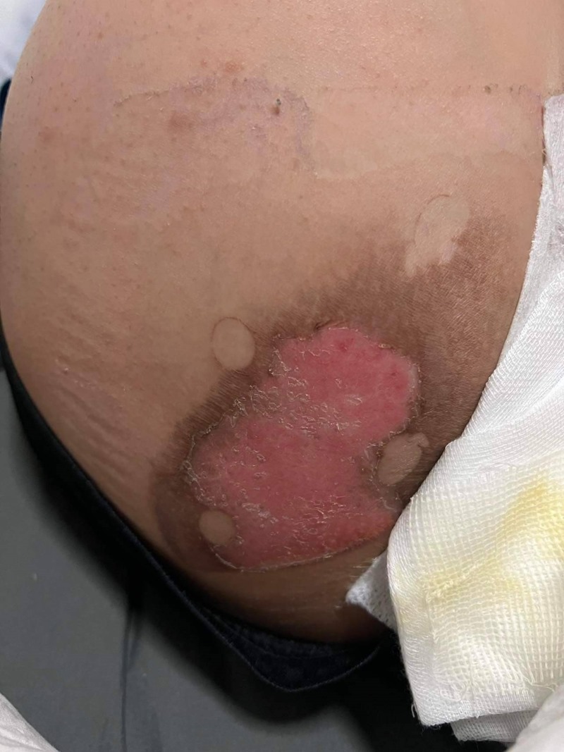 ดราม่าร้านบุฟเฟ่ต์