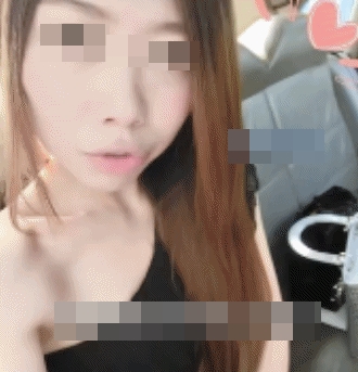 สำลักอาหารจนซี่โครงหัก