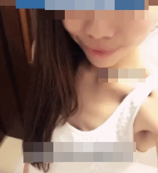 สำลักอาหารจนซี่โครงหัก