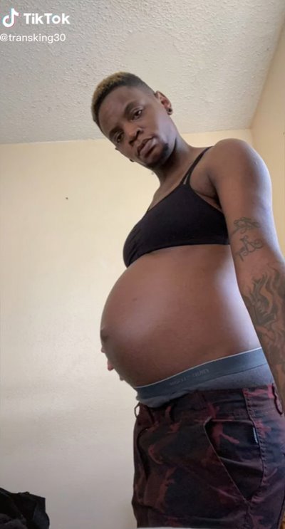 ชายข้ามเพศท้อง