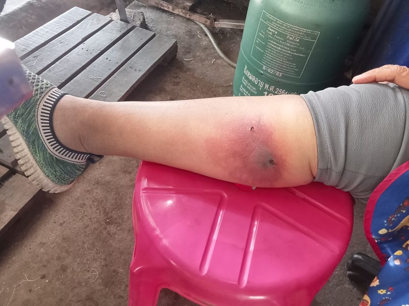 แผลติดเชื้อ