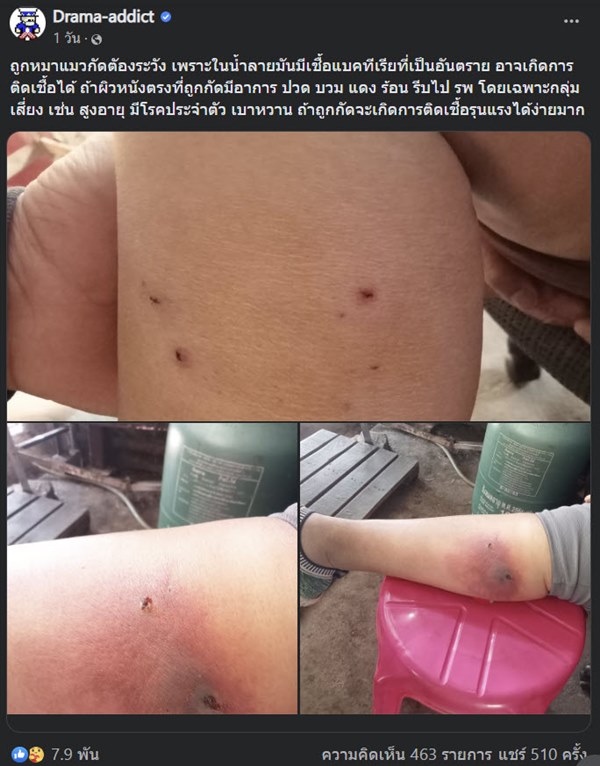 แผลติดเชื้อ