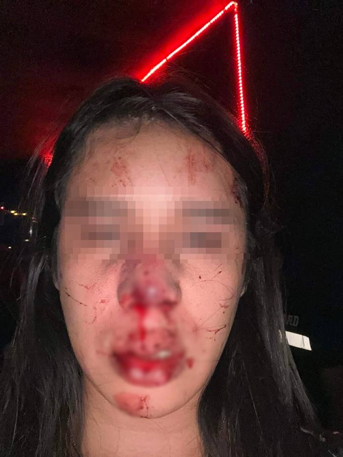 ทำร้ายสาวประเภทสอง