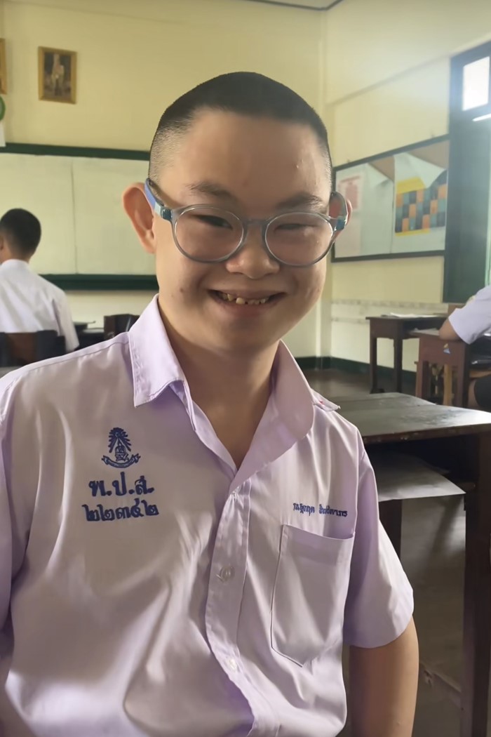 น้องบุ๋น เด็กพิเศษ