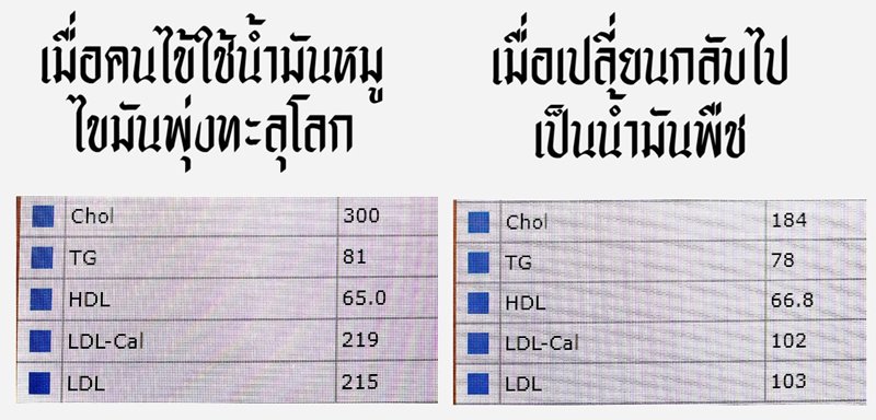 ไขมันในเลือด