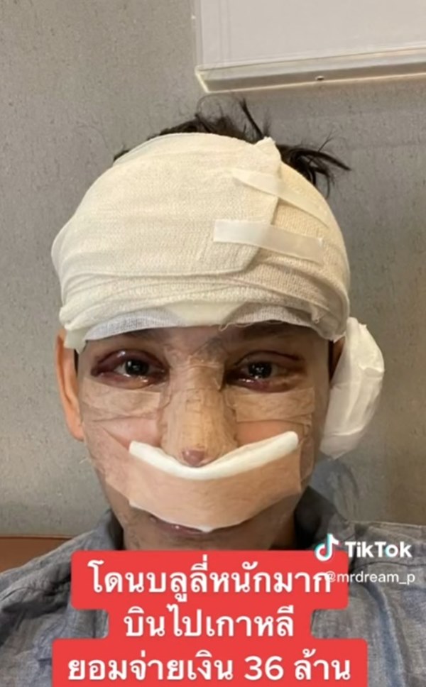 ศัลยกรรมเกาหลี