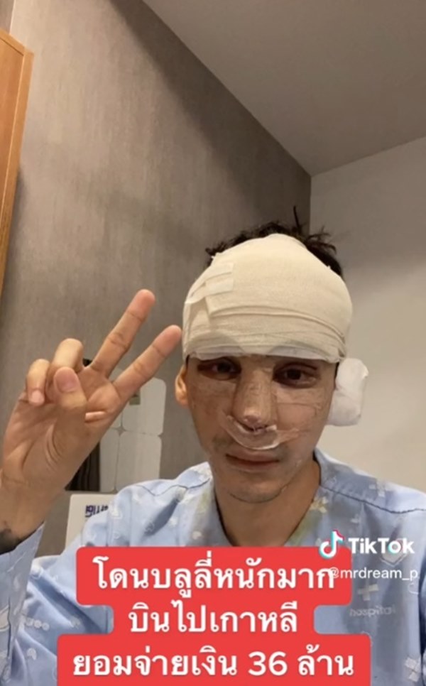 ศัลยกรรมเกาหลี