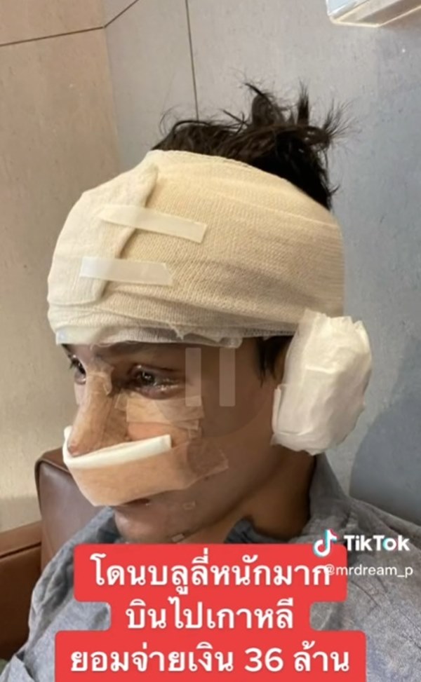 ศัลยกรรมเกาหลี