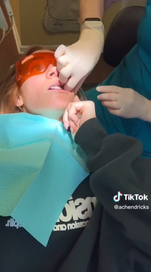 เมล็ดดอกไม้แทงกระพุ้งแก้ม