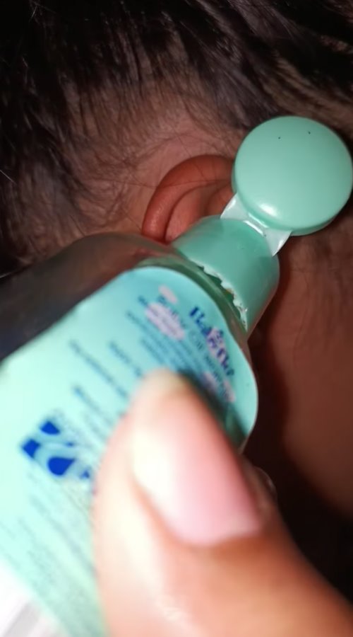 แมลงเข้าหู