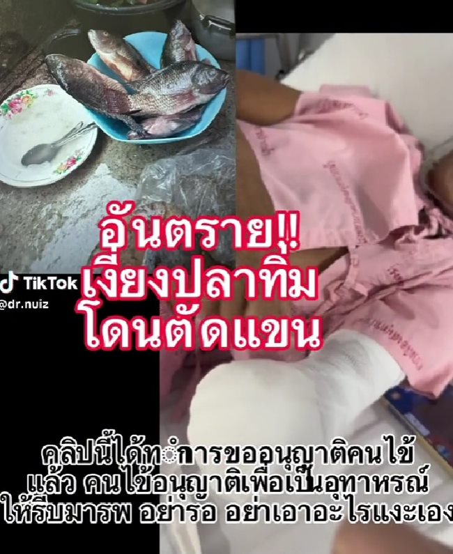 เงี่ยงปลาทิ่ม