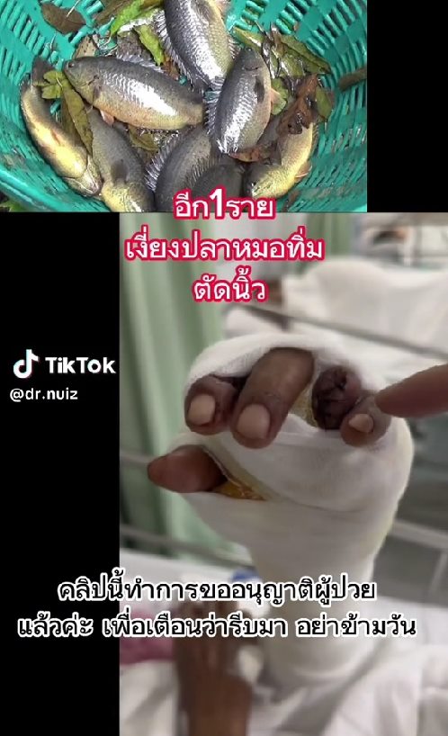 เงี่ยงปลาทิ่ม