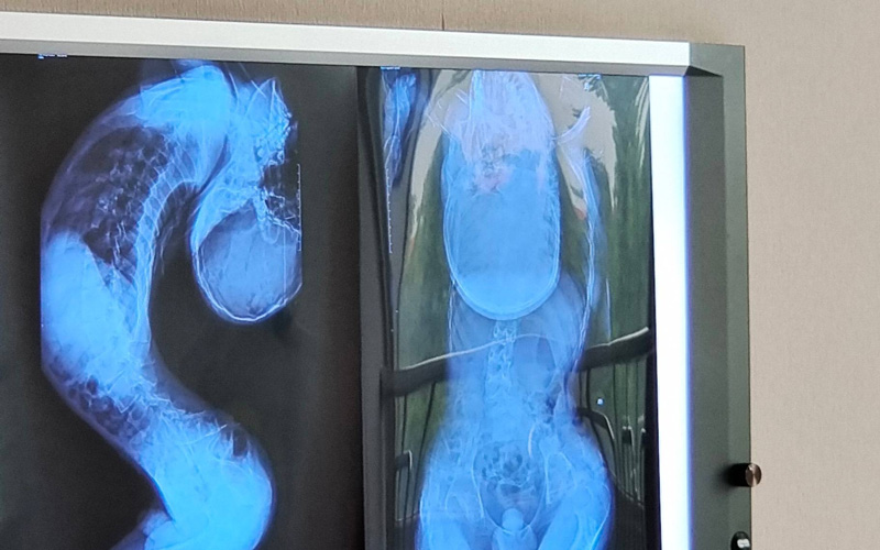 หนุ่มตัวพับ