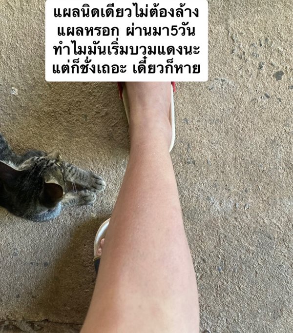 ติดเชื้อในกระแสเลือด