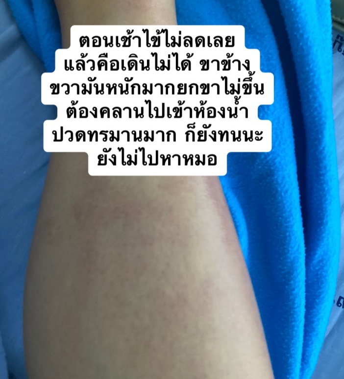 ติดเชื้อในกระแสเลือด