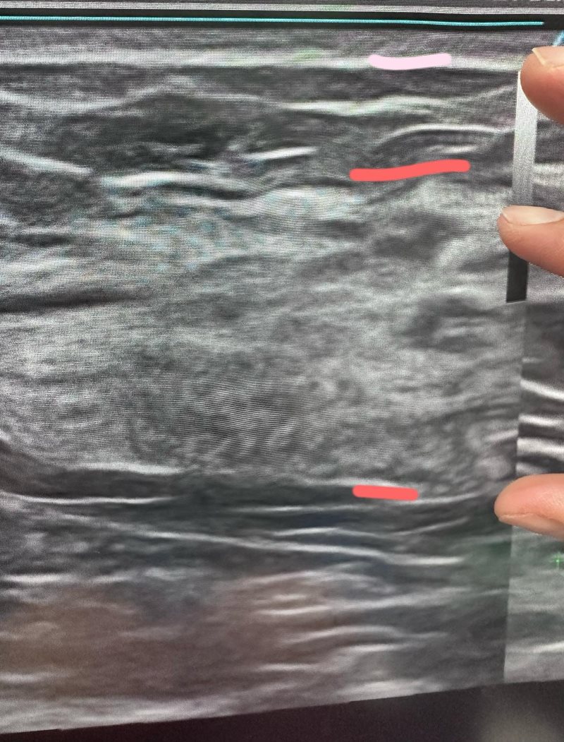 เน็ตไอดอลจีน