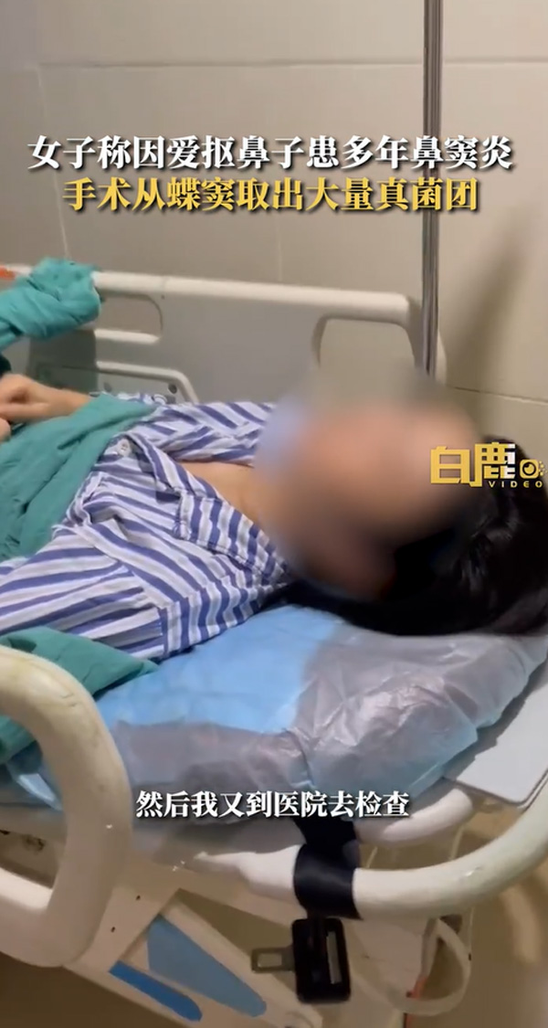 เชื้อราในจมูก