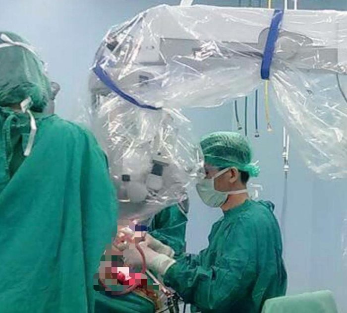 เส้นเลือดในสมองโป่งพอง