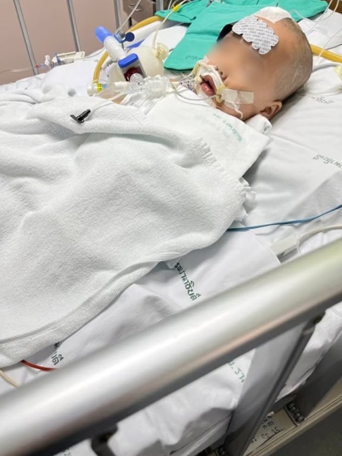 เด็กเส้นเลือดในสมองแตก