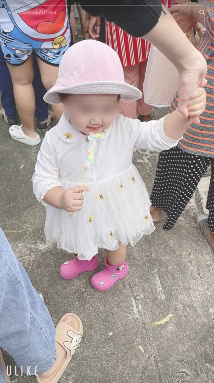 เด็กเส้นเลือดในสมองแตก