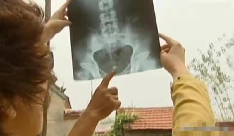 หมู่บ้านผมขาว