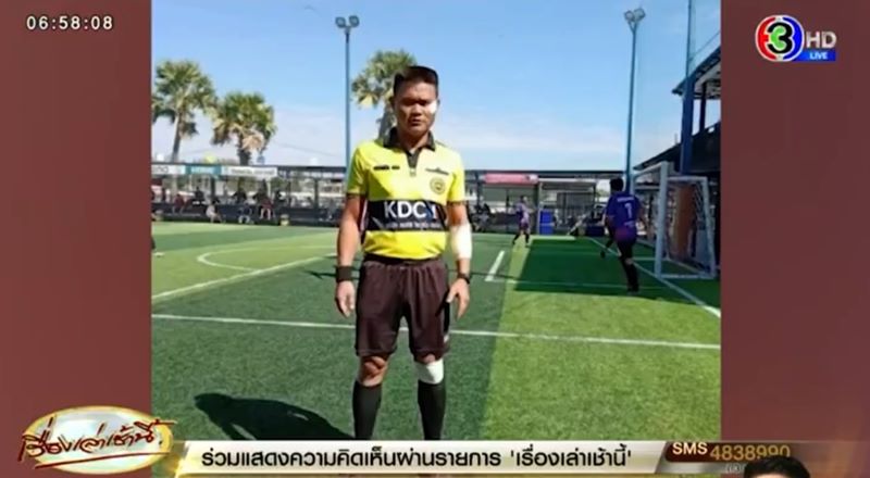 แป๊กโก้ พิเชษฐ์