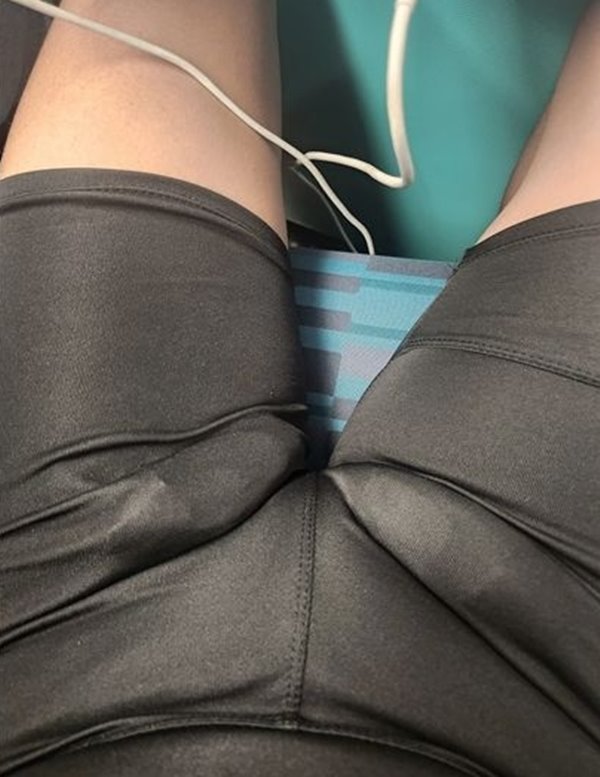 ก้อนปริศนาในขากางเกง