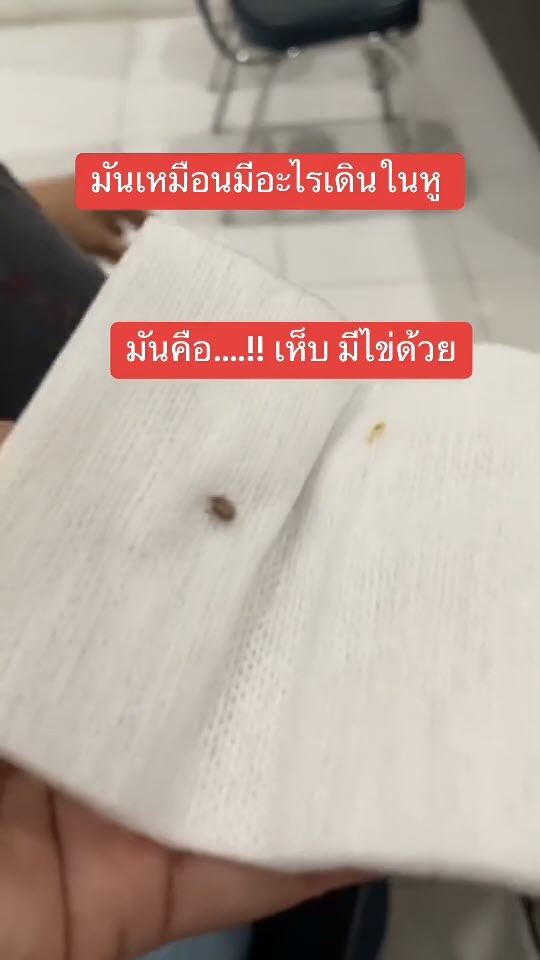 เห็บเข้าหู