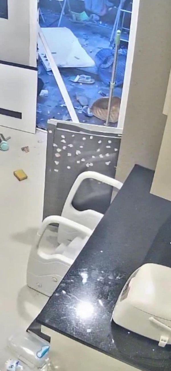 เตาแก๊สระเบิดใส่หน้า