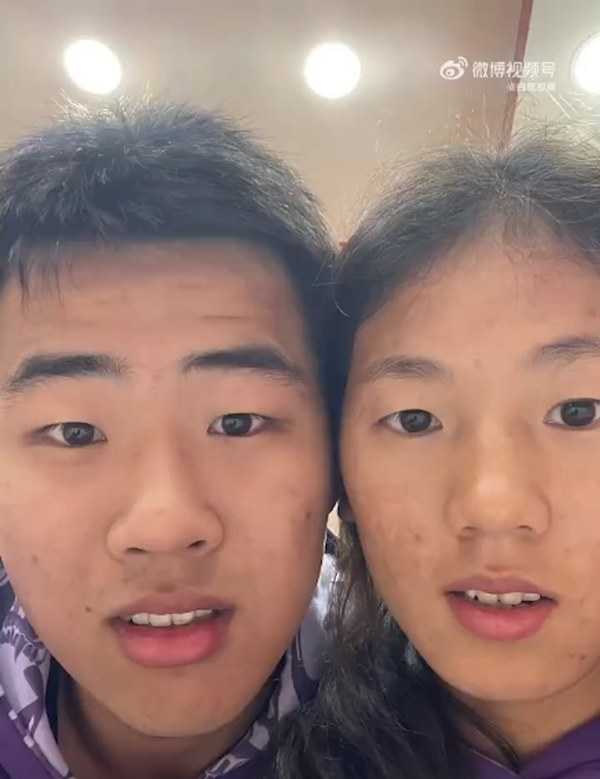 คู่รักหน้าเหมือน